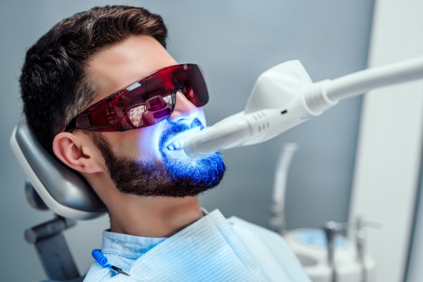 Smile Design Procedure Office Teeth Whitening