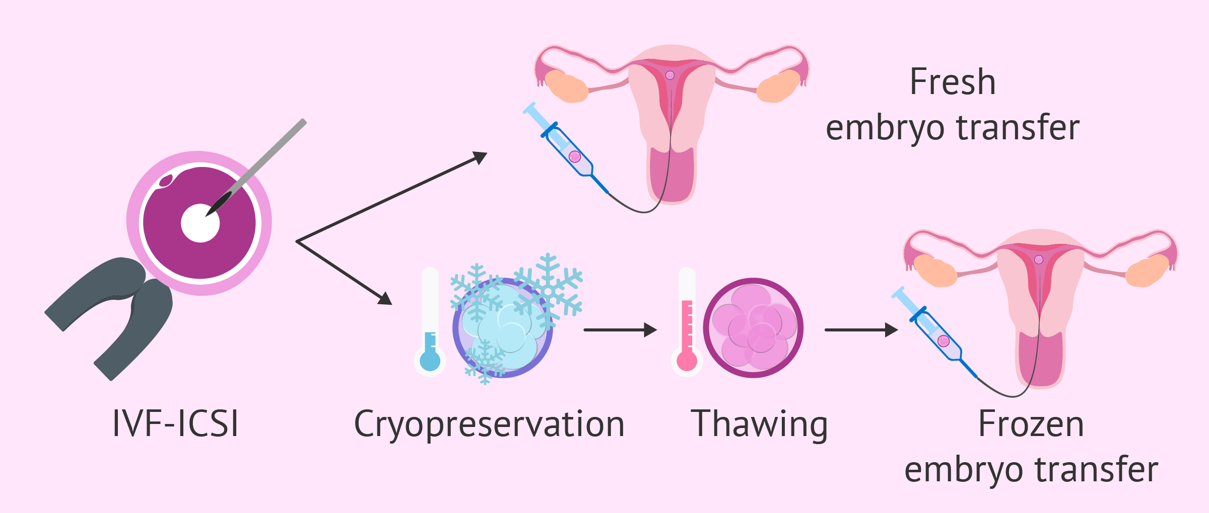 Egg Freezing  Procedure & ICSI Treatment