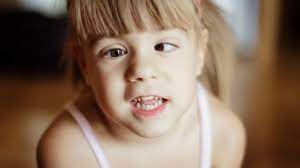 SQUINT AND ORTHOPTICS Squint Surgery Single Muscles Single Eye