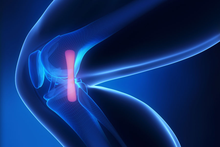 ACL Surgery