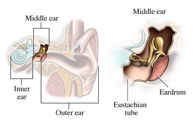 Tympanoplasty