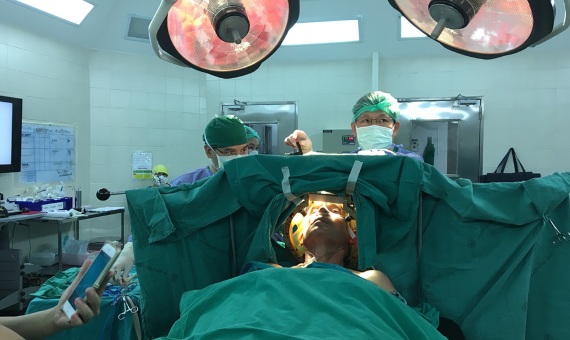 Brain Tumor Surgery, India
