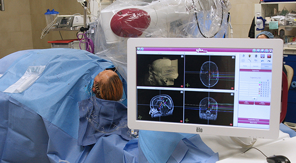 Brain Tumor Surgery, India