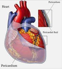 Pericardiectomy