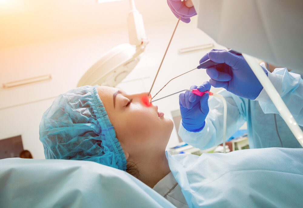 Nasal Polyp Surgery