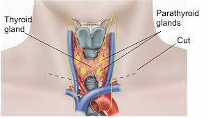 Thyroidectomy