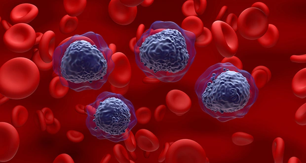 Multiple Myeloma Treatment