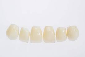 INDIVIDUAL CROWNS IPS EMAX CROWN or VENEERS