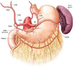 D2 Distal Radical Gastrectomy