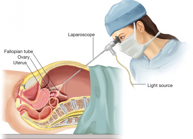 Diagnostic Lap