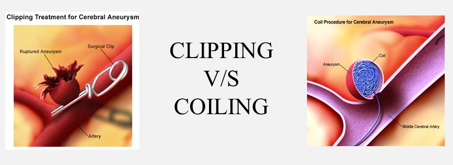 Cerebral Dsa And Based On DSA Coiling Or Clipping or Cerebral Angiogram