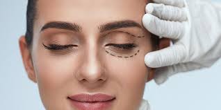 ORBIT AND OCULOPLASTY Lid retraction repair Single Eye