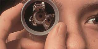 DIAGNOSTICS Both Eye Gonioscopy