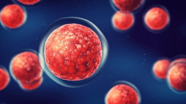 Bone Marrow Transplant Allogenic