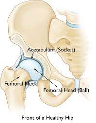 Hip Resurfacing Surgery