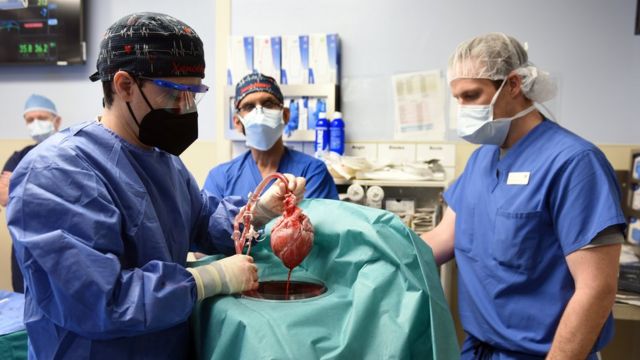 Kidney Transplant