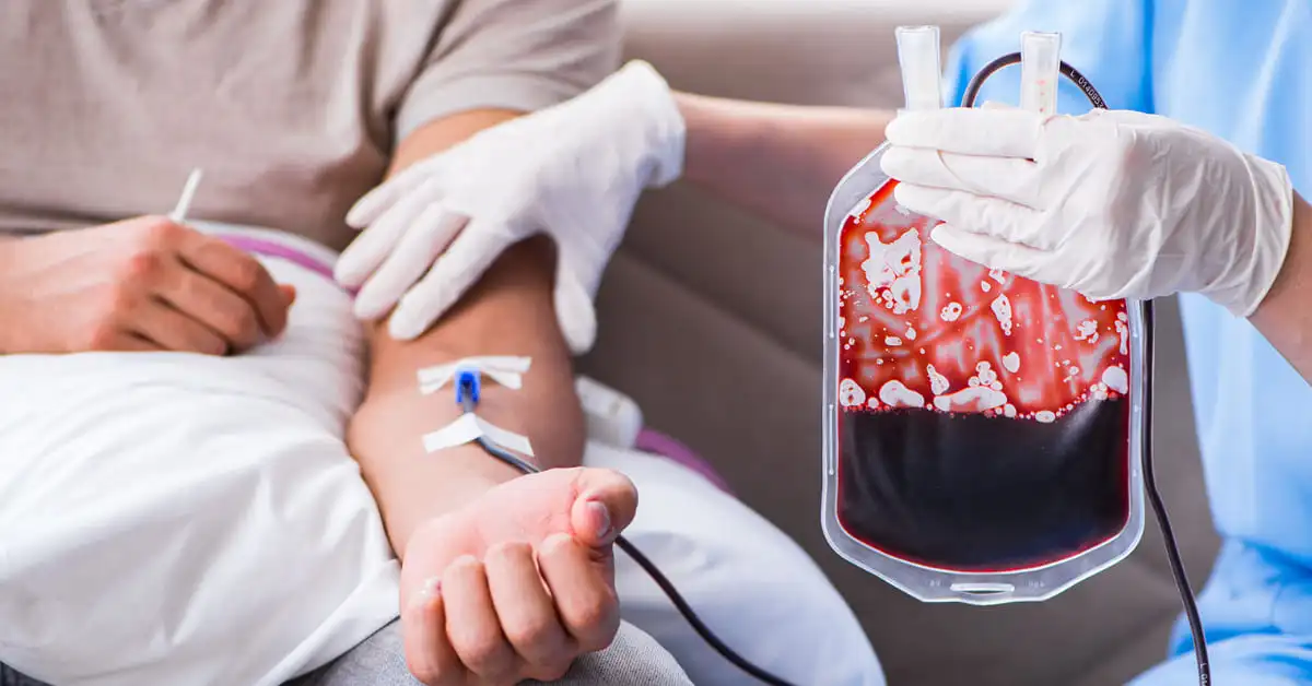 Bone Marrow Transplant Allogenic