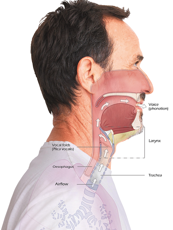 Laryngectomy