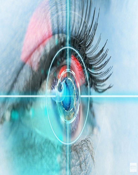 Femto Cataract Surgery