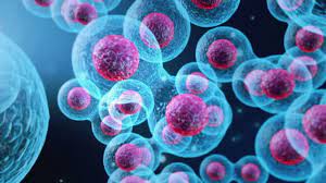 Bone Marrow Transplant Allogenic